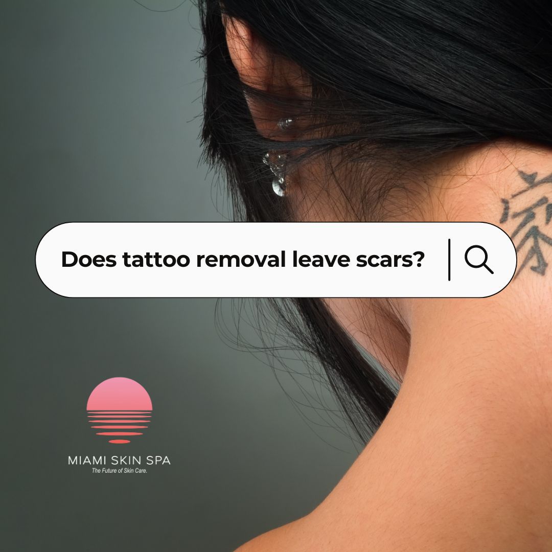 Does Tattoo Removal Leave Scars? at Miami Skin Spa in Brickell Does Tattoo Removal Leave Scars? at Miami Skin Spa in Brickell
