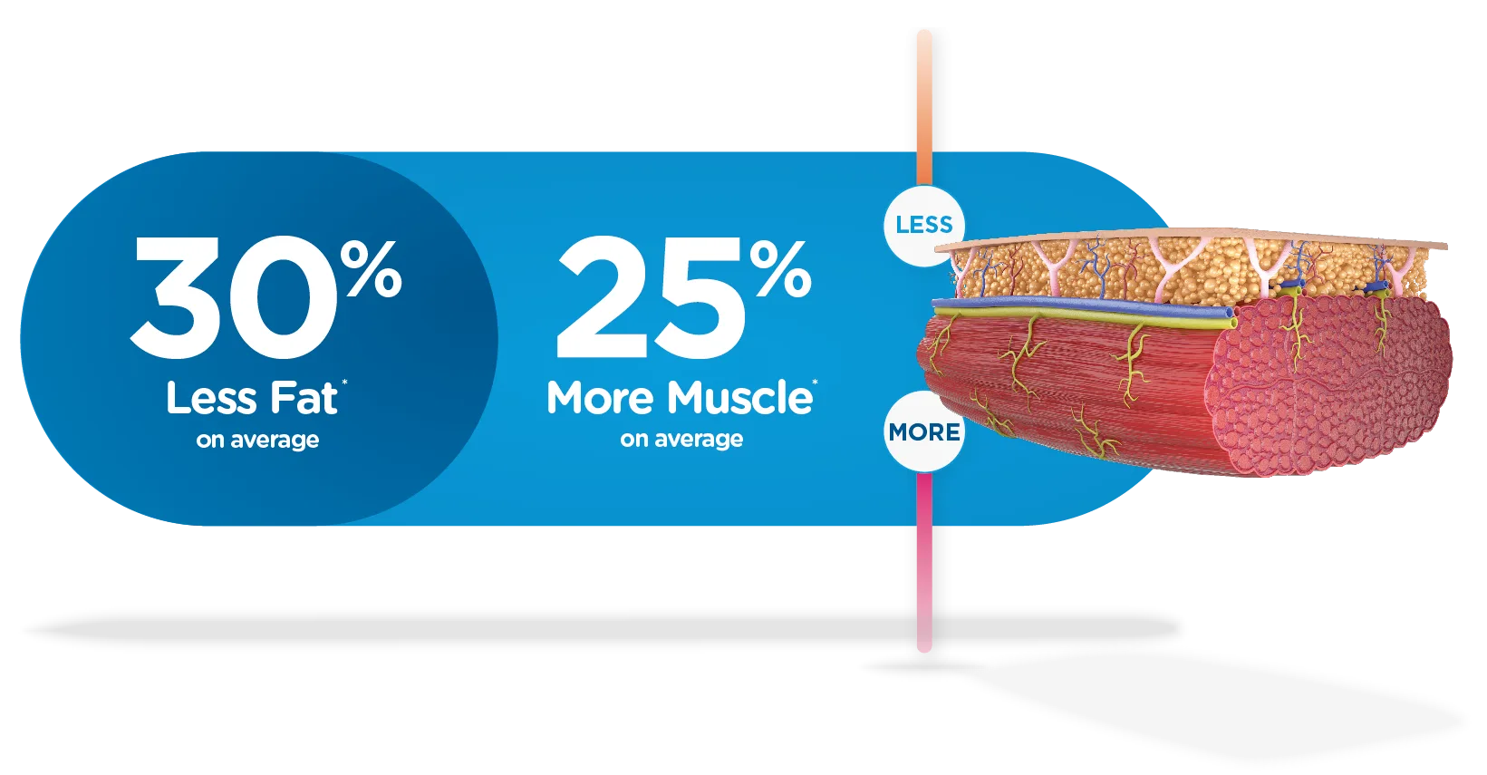 Emsculpt NEO reduces fat and builds muscle in a single session — how it compares to fat-only treatments