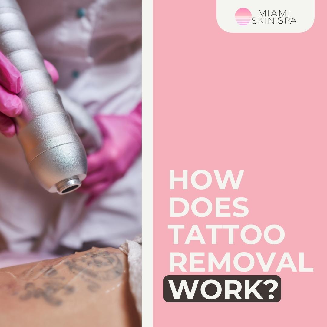 How Many Tattoo Removal Sessions Will I Actually Need?