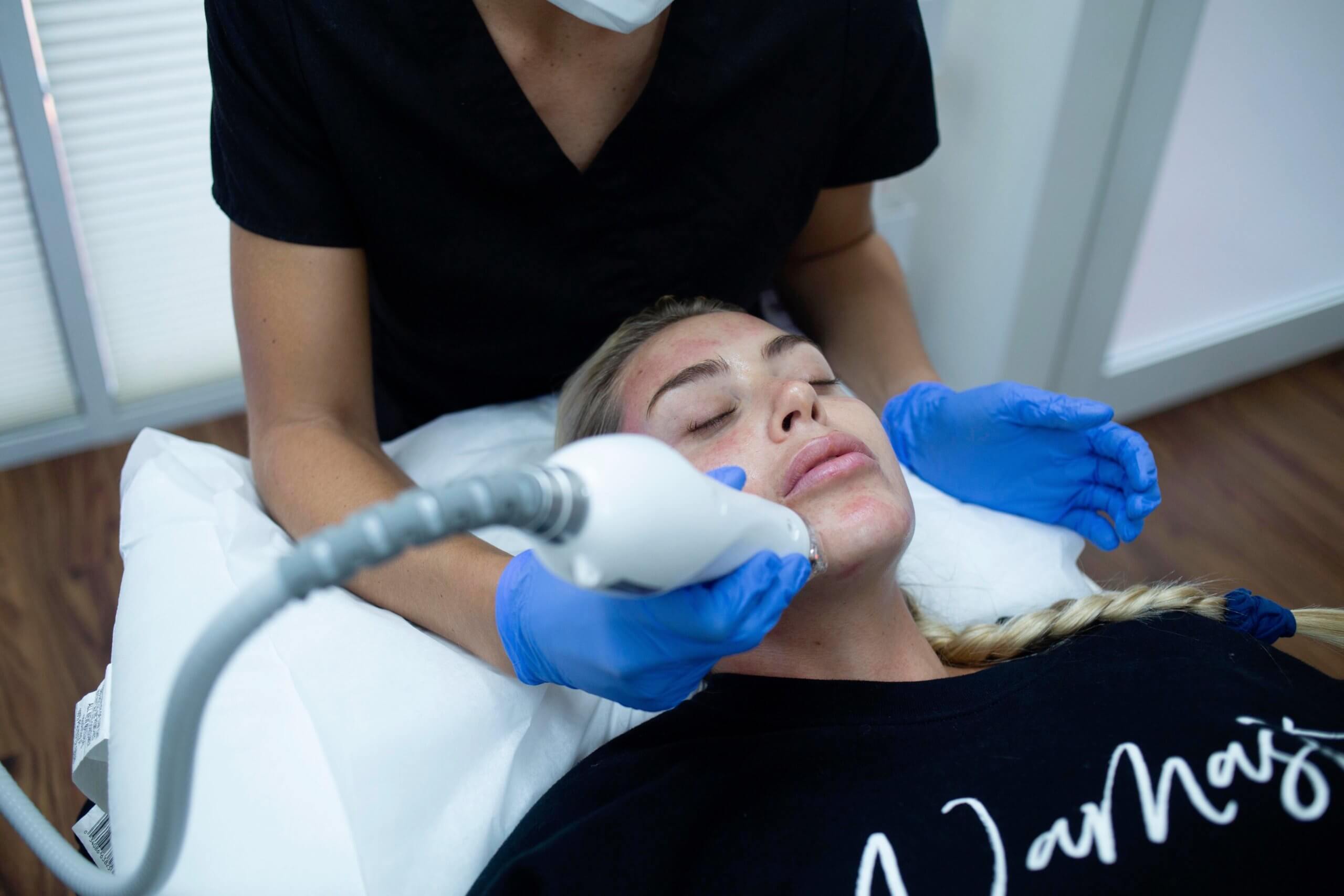 Advantages of RF Microneedling vs. Laser Scar Removal at Miami Skin Spa in Brickell Advantages of RF Microneedling vs. Laser Scar Removal at Miami Skin Spa in Brickell