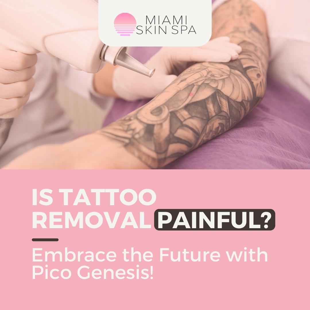 Is Tattoo Removal Painful? at Miami Skin Spa in Brickell Is Tattoo Removal Painful? at Miami Skin Spa in Brickell