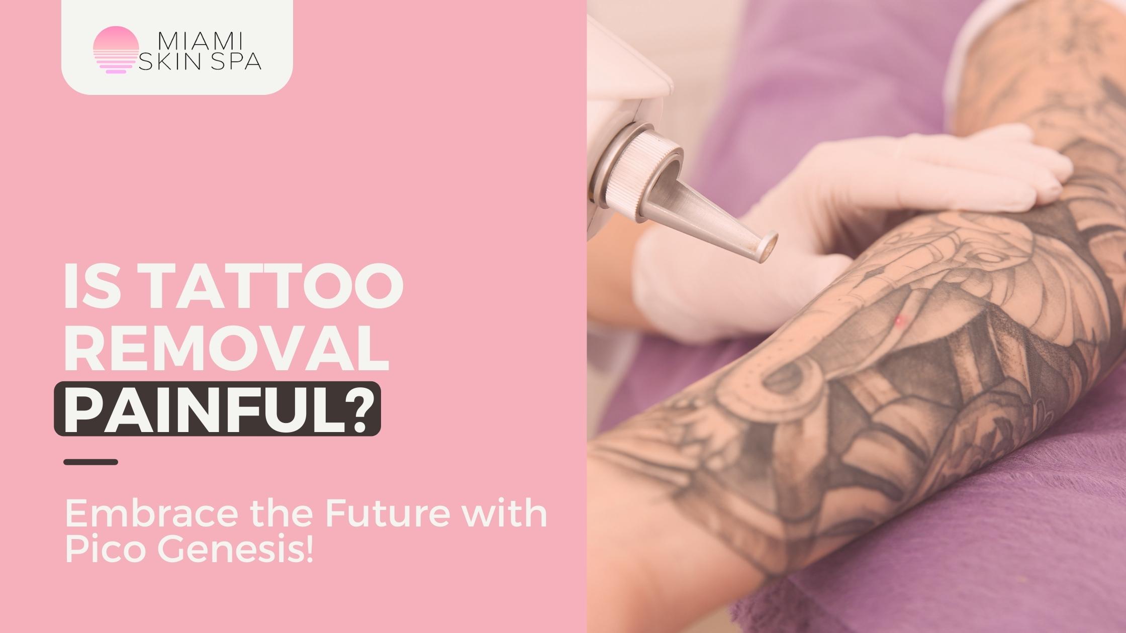 Comfortable laser tattoo removal with topical numbing at Miami Skin Spa in Brickell, Miami.