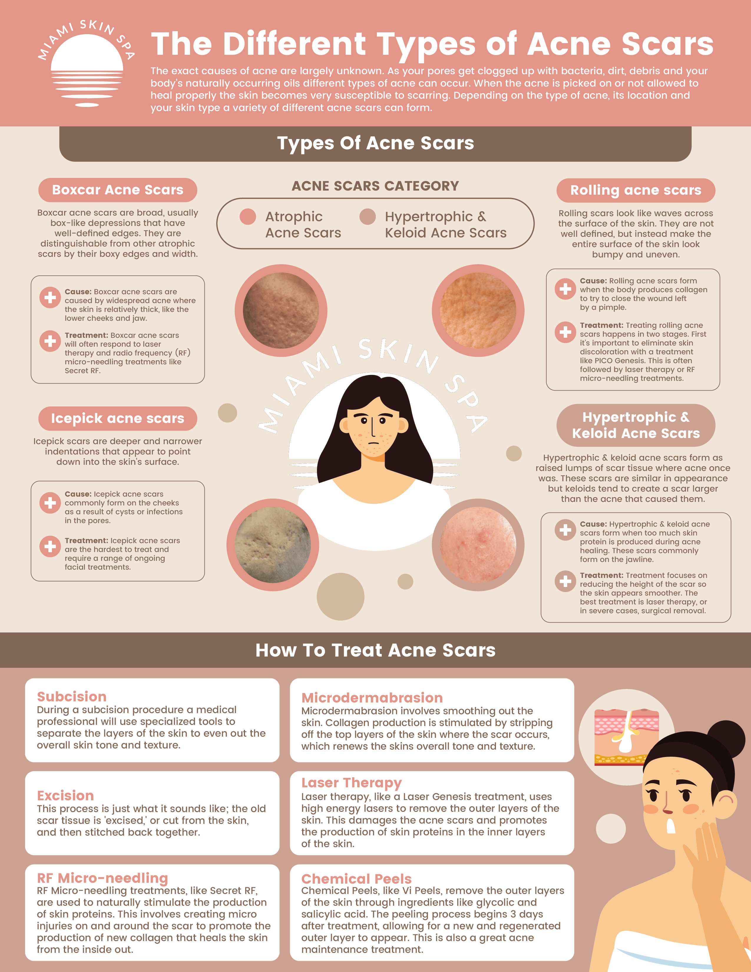 An infographic explaining the different types of acne scars including boxcar, icepick, rolling, and hypertrophic scars with causes and treatments An infographic explaining the different types of acne scars including boxcar, icepick, rolling, and hypertrophic scars with causes and treatments