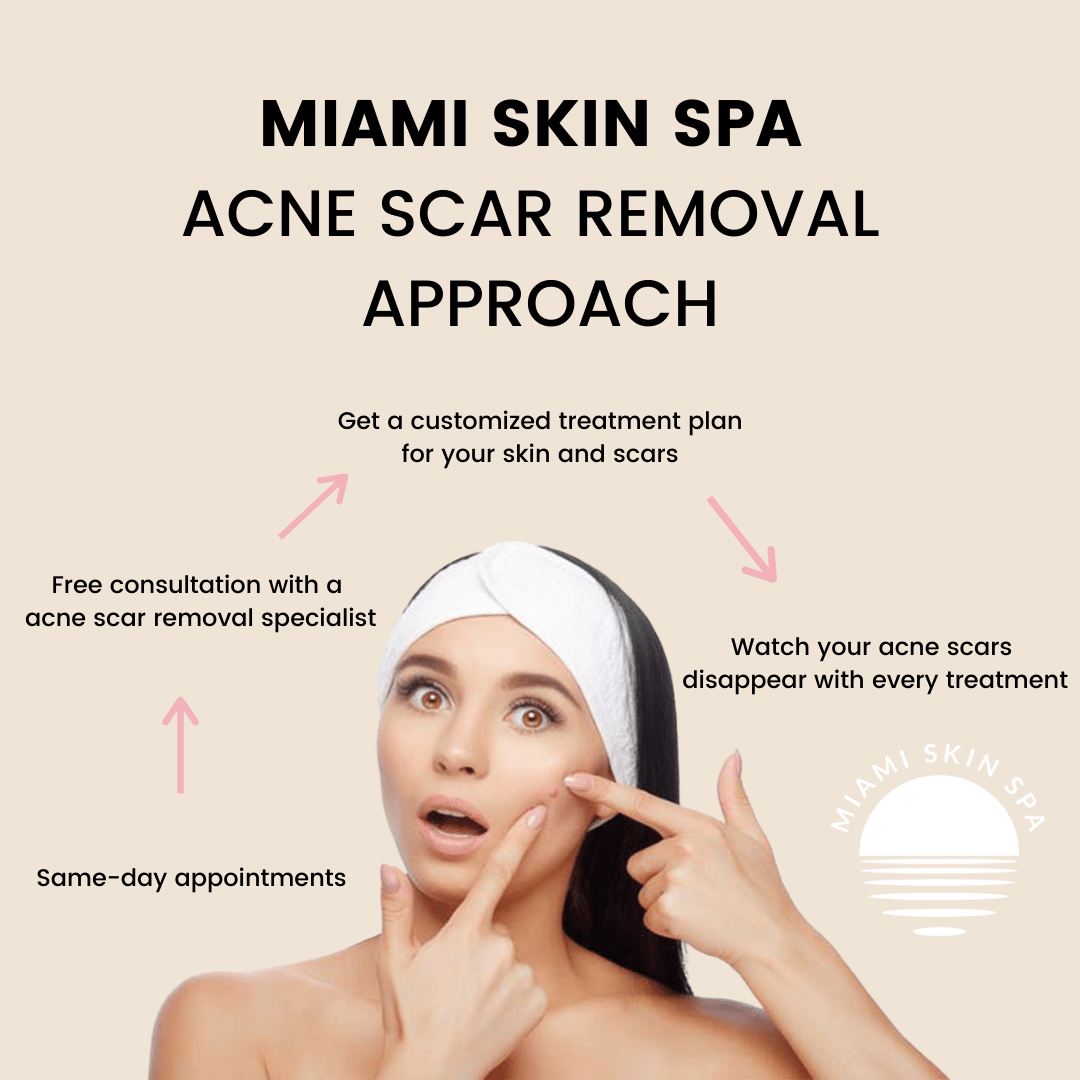 Miami Skin Spa acne scar removal approach — consultation, treatment plan, and results Miami Skin Spa acne scar removal approach — consultation, treatment plan, and results