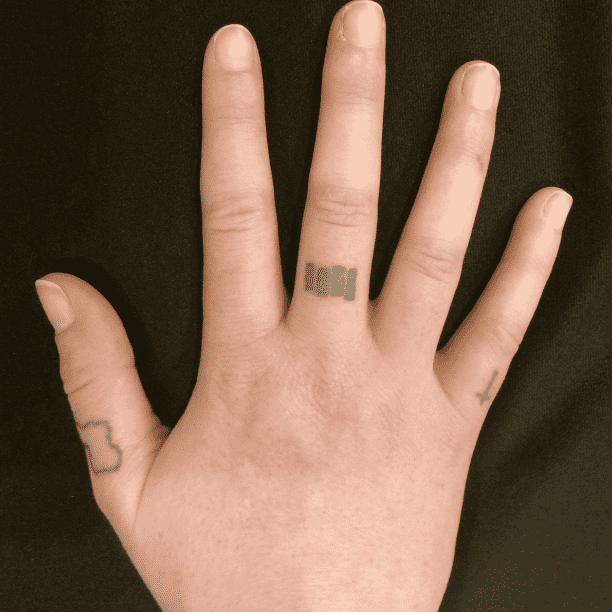 Tattoo before laser removal at Miami Skin Spa in Brickell.