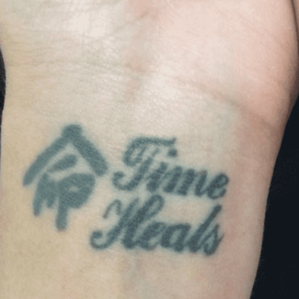 Tattoo before laser removal at Miami Skin Spa in Brickell.