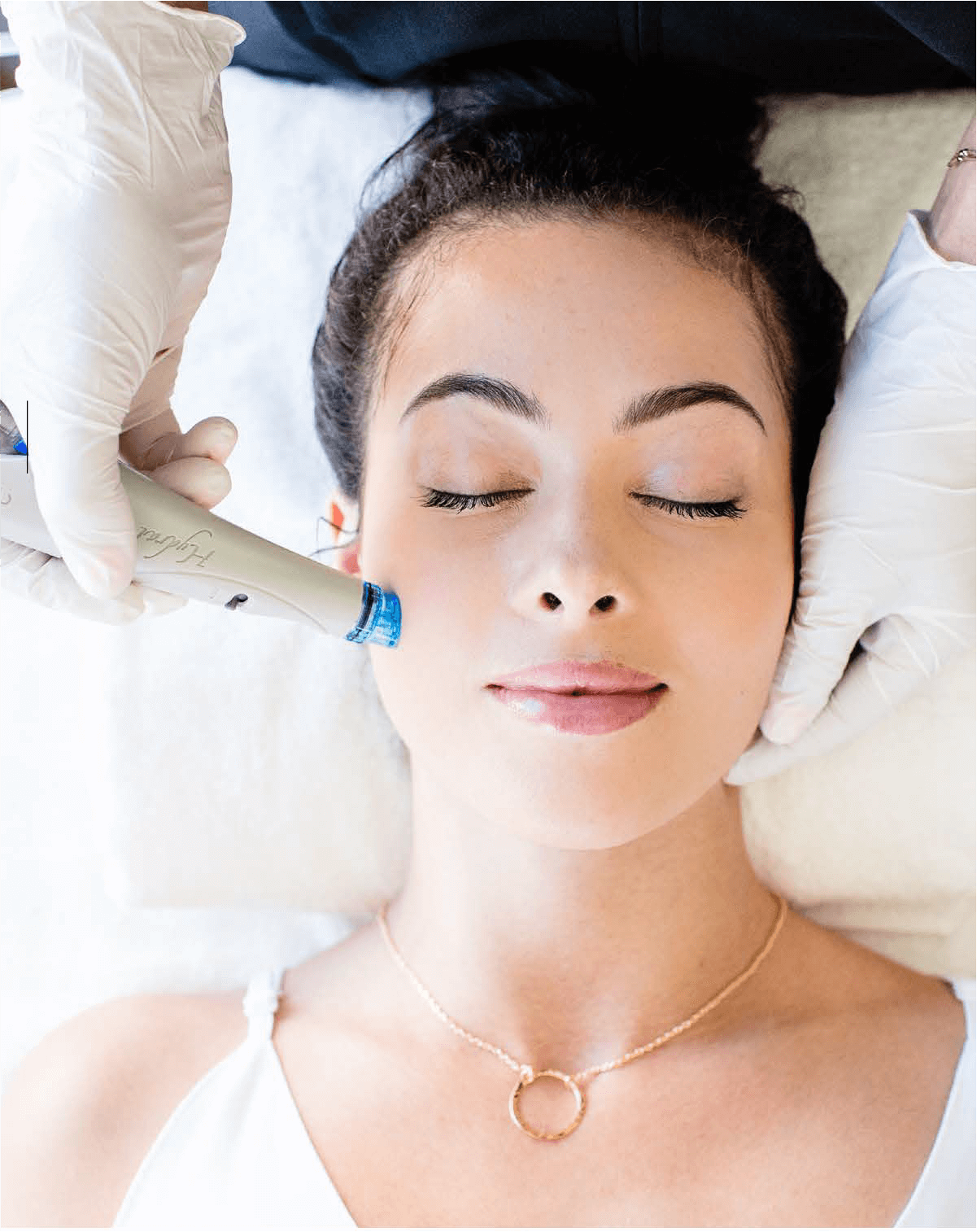 Acne Scar Facial Miami Facial at Miami Skin Spa Brickell — acne scar treatment for clearer skin